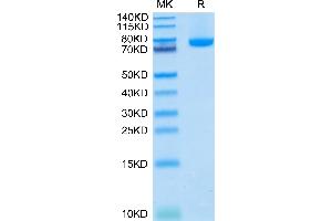 Human BAFF (Trimer) on Tris-Bis PAGE under reduced condition. (BAFF Protein (Trimer) (hFc-DYKDDDDK Tag))