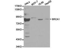 Western Blotting (WB) image for anti-Breast Cancer 1 (BRCA1) antibody (ABIN1871342) (BRCA1 Antikörper)