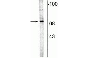 Western blot of rat hippocampal lysate showing specific immunolabeling of the ~70 kDa ChAT. (Choline Acetyltransferase Antikörper)