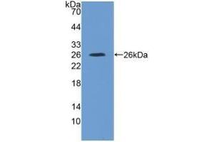 Detection of Recombinant IL4R, Rat using Polyclonal Antibody to Interleukin 4 Receptor (IL4R) (IL4 Receptor Antikörper  (AA 26-232))