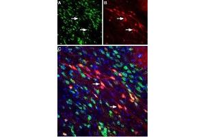 Expression of Neuropilin-2 in mouse substantia nigra pars compacta - Immunohistochemical staining of perfusion-fixed frozen mouse brain sections using Anti-Neuropilin-2 (NRP2) (extracellular) Antibody (ABIN7043380, ABIN7044700 and ABIN7044701), (1:400). (NRP2 Antikörper  (Extracellular, N-Term))