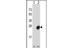 Western blot analysis of MID1IP1 (arrow) using rabbit polyclonal MID1IP1 Antibody (N-term) (ABIN656689 and ABIN2845926). (m1ip1 Antikörper  (N-Term))