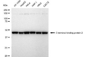Western blotting analysis using C-terminal binding protein 2 antibody (ABIN7797816). (Rekombinanter CTBP2 Antikörper)