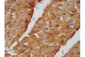 IHC image of ABIN7160937 diluted at 1:400 and staining in paraffin-embedded human heart tissue performed on a Leica BondTM system. (NDUFB8 Antikörper  (AA 29-132))