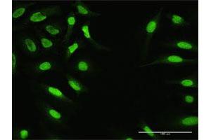 Immunofluorescence of purified MaxPab antibody to ZNF124 on HeLa cell.