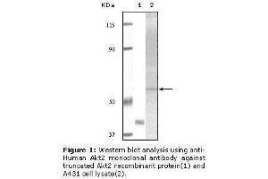 Image no. 1 for anti-V-Akt Murine Thymoma Viral Oncogene Homolog 2 (AKT2) antibody (ABIN232107) (AKT2 Antikörper)