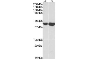 ABIN1782132 (0. (GOT2 Antikörper  (Internal Region))