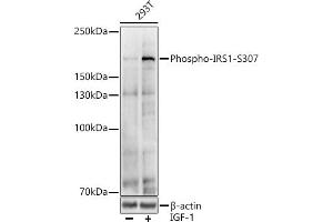 Western blot analysis of extracts of various cell lines, using Phospho-IRS1-S307 antibody (ABIN6135245, ABIN6136114, ABIN6136115 and ABIN6225577) at 1:1000 dilution. (IRS1 Antikörper  (pSer307))