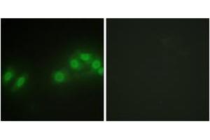 Immunofluorescence analysis of HepG2 cells, using LATS2 Antibody. (LATS2 Antikörper  (AA 541-590))