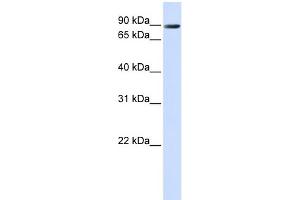 WB Suggested Anti-TMEM16K Antibody Titration:  0.