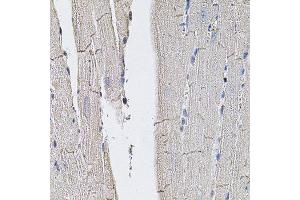 Immunohistochemistry of paraffin-embedded mouse heart using SLC2A3 antibody.