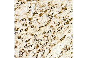 Immunohistochemistry of paraffin-embedded mouse brain using RPL10A Rabbit mAb (ABIN7269992) at dilution of 1:25 (40x lens).