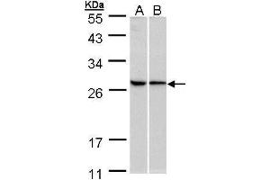 WB Image Sample (30 ug of whole cell lysate) A:293T B:HeLa 10% SDS PAGE antibody diluted at 1:500 (RPL13A Antikörper)