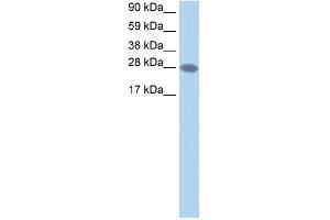 WB Suggested Anti-TCEA2 Antibody Titration:  1. (TCEA2 Antikörper  (N-Term))
