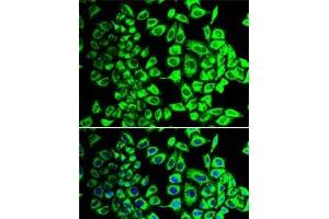 Immunofluorescence analysis of HeLa cells using SDHA Polyclonal Antibody (SDHA Antikörper)