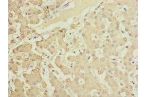 Immunohistochemistry of paraffin-embedded human liver tissue using ABIN7165639 at dilution of 1:100 (HOOK2 Antikörper  (AA 440-719))