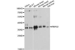 Western blot analysis of extracts of various cell lines, using PRPS2 antibody. (PRPS2 Antikörper)