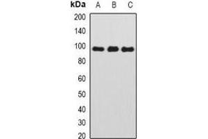Western blot analysis of TAFI110 expression in HEK293T (A), MCF7 (B), mouse thymus (C) whole cell lysates.