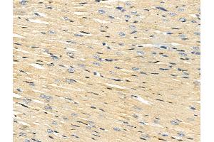 ABIN7093197 and ABIN7097208 at 1/100 staining Rat heart tissue by IHC-P. (ACSS1 Antikörper)