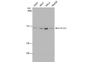 WB Image COL3A1 antibody [C2C3], C-term detects COL3A1 protein by western blot analysis.