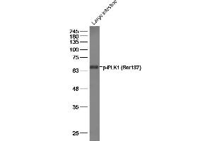 Mouse large intestine lysates, probed with PLK1 (Ser137) Polyclonal Antibody, unconjugated at 1:500 overnight at 4°C followed by a conjugated secondary antibody for 60 minutes at 37°C. (PLK1 Antikörper  (pSer137))