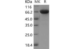 Immunoglobulin Superfamily, Member 8 (IGSF8) protein (His tag)