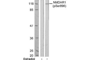 Image no. 1 for anti-NMDA Receptor 1 (NMDA R1) (pSer896) antibody (ABIN196794) (NMDA 1 Receptor Antikörper  (pSer896))