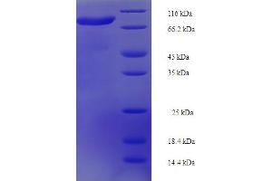 SDS-PAGE (SDS) image for Kelch-Like 36 (KLHL36) (AA 1-553) protein (His-SUMO Tag) (ABIN5711674)