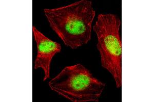 Fluorescent confocal image of Hela cell stained with SUMO2/3 Antibody (C-term E69) (ABIN1882138 and ABIN2845503). (SUMO2/3 Antikörper  (C-Term))