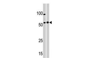 Western blot analysis of PKMYT1 polyclonal antibody  in A-375 (left) and Y-79 (right) cell line lysate. (PKMYT1 Antikörper  (C-Term))