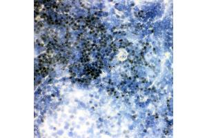 anti-Runt-Related Transcription Factor 1 (RUNX1) (AA 200-233), (Middle Region) antibody