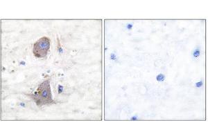 Immunohistochemistry (IHC) image for anti-Solute Carrier Family 2 (Facilitated Glucose Transporter), Member 1 (SLC2A1) (C-Term) antibody (ABIN1848582) (GLUT1 Antikörper  (C-Term))