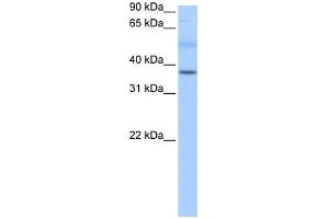WB Suggested Anti-SERTAD2 Antibody Titration:  0. (SERTAD2 Antikörper  (N-Term))