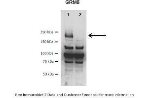 Western Blotting (WB) image for anti-Glutamate Receptor, Metabotropic 6 (GRM6) (C-Term) antibody (ABIN2779742)