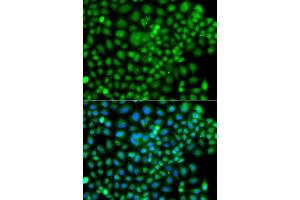 Immunofluorescence analysis of A549 cells using SUMO4 antibody (ABIN5975591). (SUMO4 Antikörper)