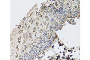 Immunohistochemistry of paraffin-embedded Human esophagus using GBF1 Polyclonal Antibody at dilution of 1:100 (40x lens). (GBF1 Antikörper)