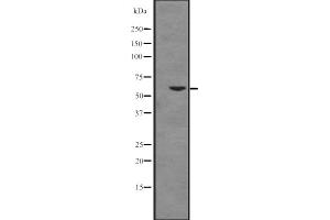 Western blot analysis of Cytochrome P450 17A1 expression in K562 cell line lysates ,The lane on the left is treated with the antigen-specific peptide. (CYP17A1 Antikörper  (Internal Region))