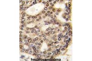 Immunohistochemistry (IHC) image for anti-Hepatoma-Derived Growth Factor (HDGF) antibody (ABIN3002632) (HDGF Antikörper)