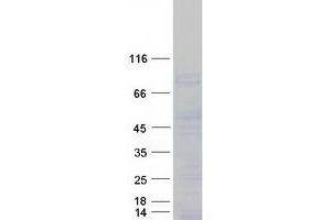 Validation with Western Blot