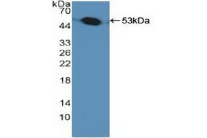 Detection of Recombinant PSMC1, Human using Polyclonal Antibody to Proteasome 26S Subunit, ATPase 1 (PSMC1) (PSMC1 Antikörper  (AA 1-440))