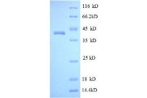 SDS-PAGE (SDS) image for Myelin Protein Zero (MPZ) (AA 30-156), (partial) protein (GST tag) (ABIN1608049)