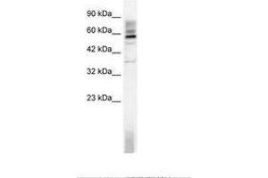 Image no. 1 for anti-TAF15 RNA Polymerase II, TATA Box Binding Protein (TBP)-Associated Factor, 68kDa (TAF15) (AA 183-232) antibody (ABIN202793) (TAF15 Antikörper  (AA 183-232))