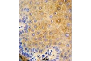 Immunohistochemistry (IHC) image for anti-Keratin 9 (KRT9) antibody (ABIN3003129) (KRT9 Antikörper)