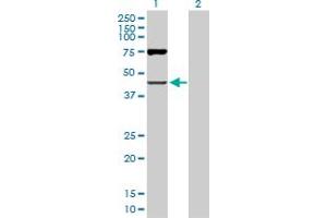 Western Blot analysis of OAS1 expression in transfected 293T cell line by OAS1 MaxPab polyclonal antibody. (OAS1 Antikörper  (AA 1-364))