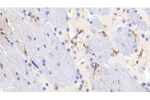 Detection of GFAP in Mouse Cerebrum Tissue using Monoclonal Antibody to Glial Fibrillary Acidic Protein (GFAP)