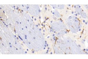 Detection of GFAP in Mouse Cerebrum Tissue using Monoclonal Antibody to Glial Fibrillary Acidic Protein (GFAP) (GFAP Antikörper  (AA 70-374))