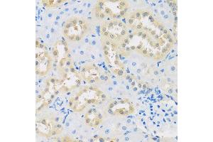 Immunohistochemistry of paraffin-embedded rat kidney using LETMD1 antibody at dilution of 1:100 (x40 lens).