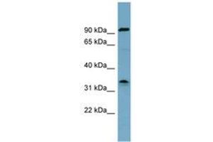 Image no. 1 for anti-serine Dehydratase (SDS) (AA 215-264) antibody (ABIN6743072) (serine Dehydratase Antikörper  (AA 215-264))