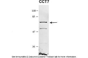 Sample Type: HEK 293 (10ug)Primary Dilution: 1:1000Secondary Antibody: conjugated goat anti-rabbitSecondary Dilution: 1:10,000Image Submitted By: Amy GrayBrigham Young University (CCT7 Antikörper  (Middle Region))