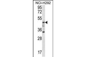 Western blot analysis in NCI-H292 cell line lysates (35ug/lane). (GBA3 Antikörper  (C-Term))